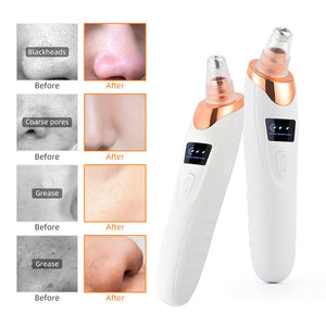 DERMA SUCTION BLACKHEAD REMOVER ACNE AND PORE CLEANSER FACIAL BEAUTY TOOL